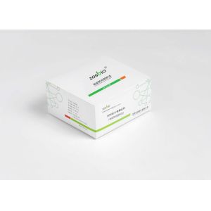  ZOSBIO CE Troponin I Detection Reagent Myocardial Injury Detection Protein Manufactures