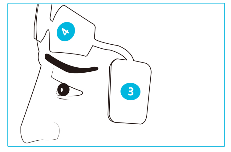 Disposable Eeg Brain Wave Sensor Non Invasive Forehead Adhesive 4 Electrodes With BIS Monitoring