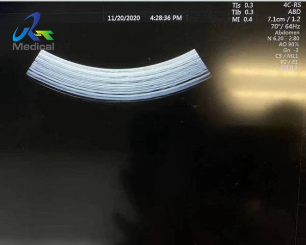 GE 4C-RS Curved Array Abdominal Ultrasound Transducer Medical Hospital