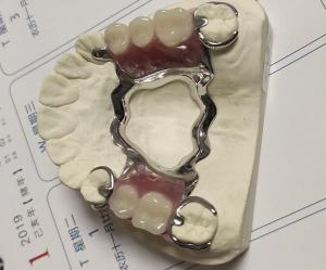 China Maxillary Arch Co Cr Alloy Partial Denture Metal Framework on sale