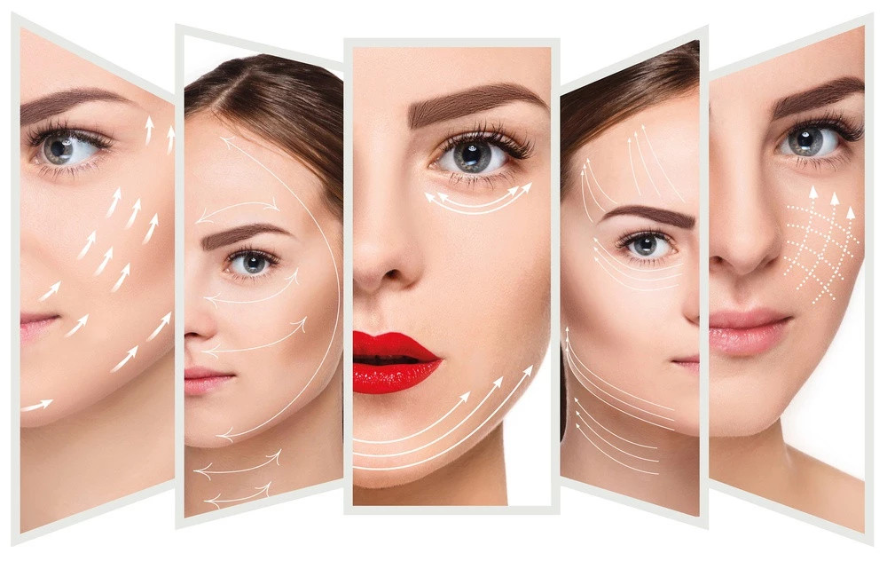 Absorbable 3D Cog Pdo Eye Thread Lift Threading To Lift Face L Blunt