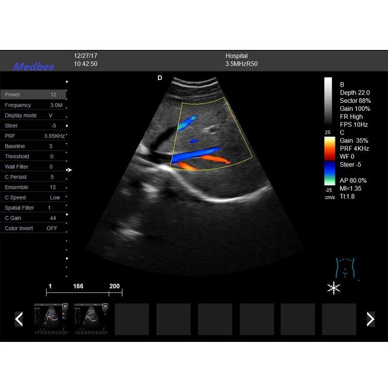 Tender Ultrasound 4D Digital Color Doppler Cheapest Ultrasound Machine Color Doppler Scanner