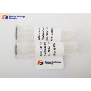 China Neuron Specific Enolase Mouse Monoclonal Antibodies CE / ISO / MSDS Approved on sale