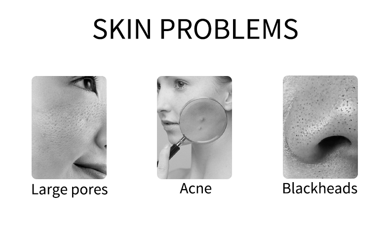 Acne Blackhead 1kg Volcanic Dead Clay Mask OEM Private Label