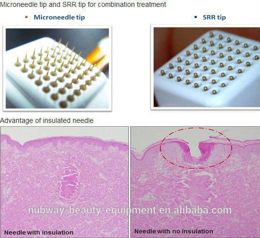 CE approved Nubway high quality 2015 big promotion fractional RF & microneedle RF device for face lifting