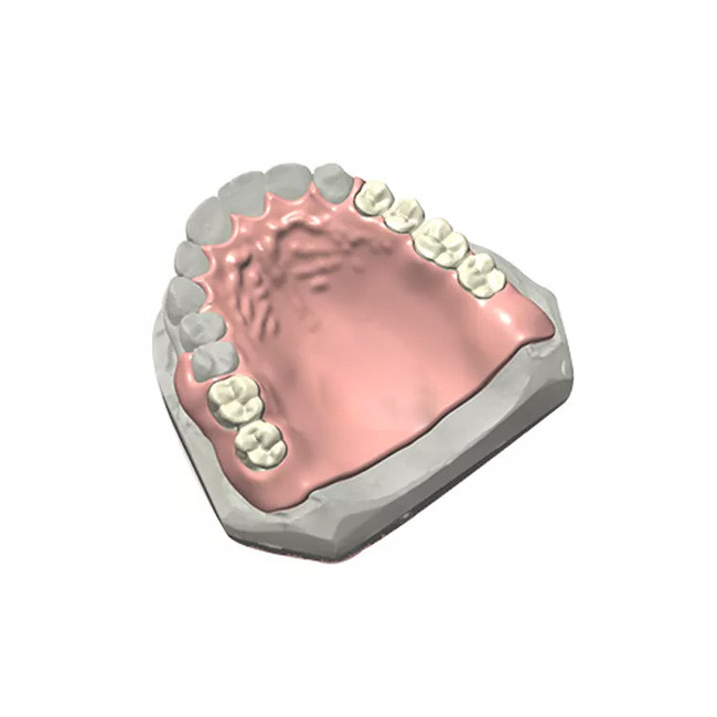 Realistic Appearance PFM Dental Crown Quality Assurance 3D Printed Dental Models