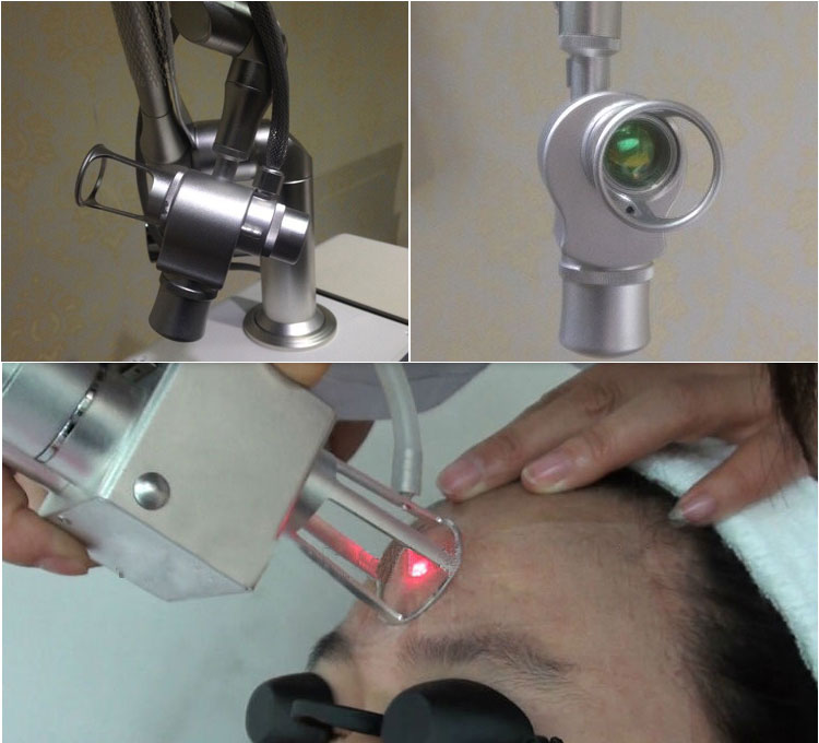 40 W high energy Best effect skin resurfacing erbium laser co2 laser 
