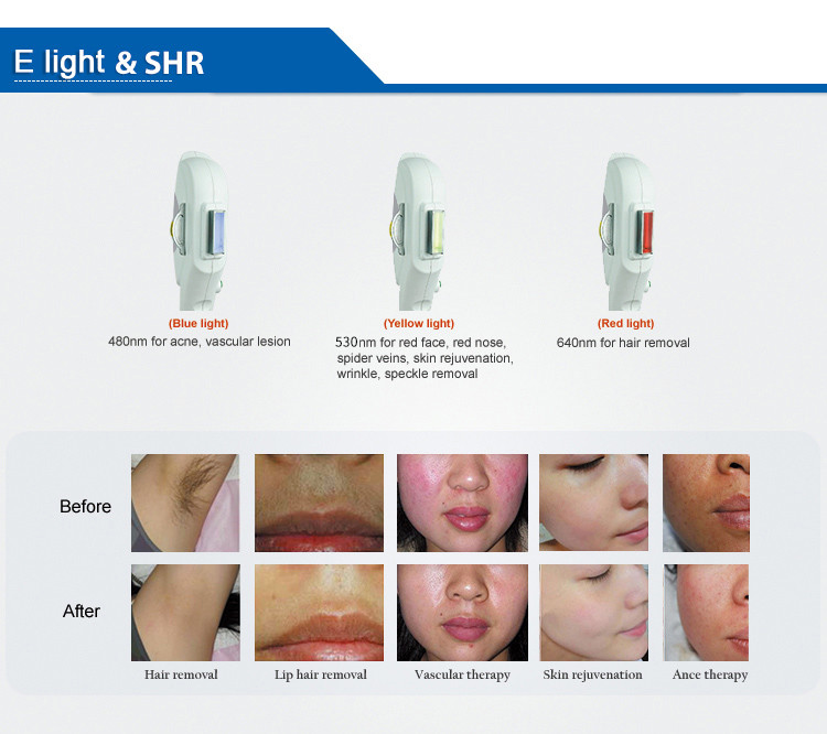 2500W 1200nm Ipl OPT Laser Hair Removal Machine For Skin Rejuvenation