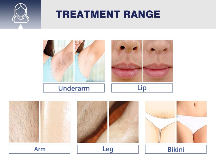 Mens Laser Hair Removal for Men Permanent 808 Hair Removal Device Ice Platinum Skin Facial Hair Remover Machine