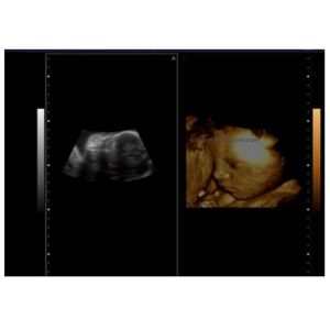 PW Function 2 Probe Connectors Handheld Doppler Machine With Multiple Image