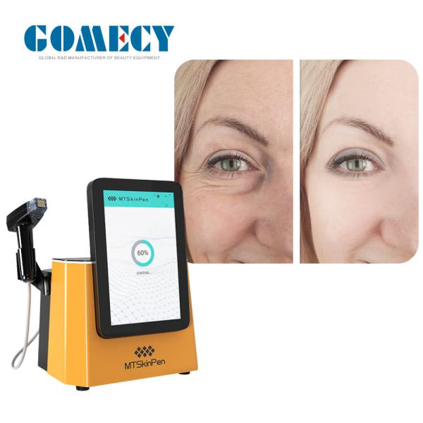 Microneedle and Fractional Modes Face Lifting and Wrinkle Reduction Microneedle