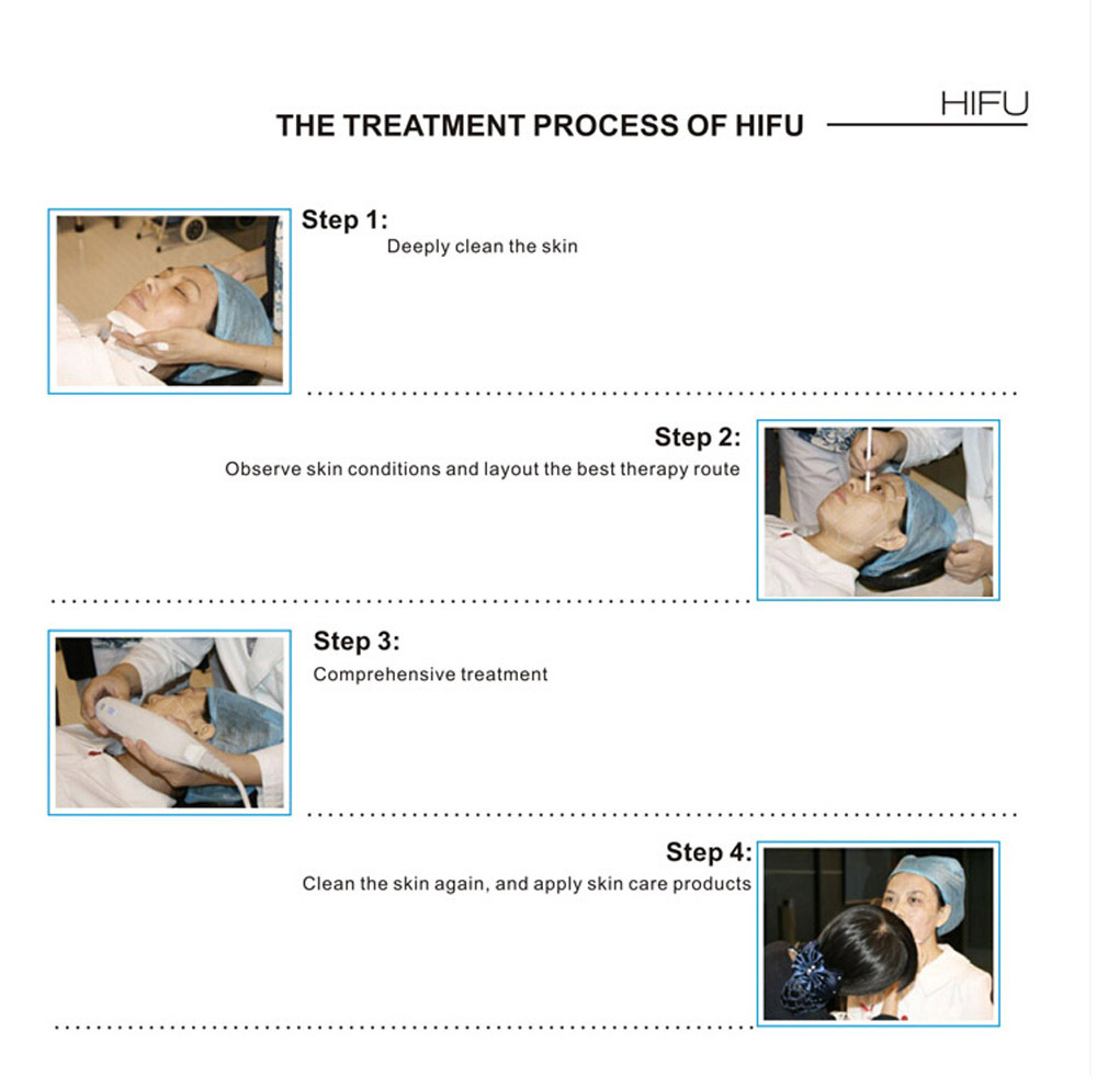 New Year Sale!! Staionary Facial Wrinkle/Freckle/Acne Removed  System HIFU Lifting Machine