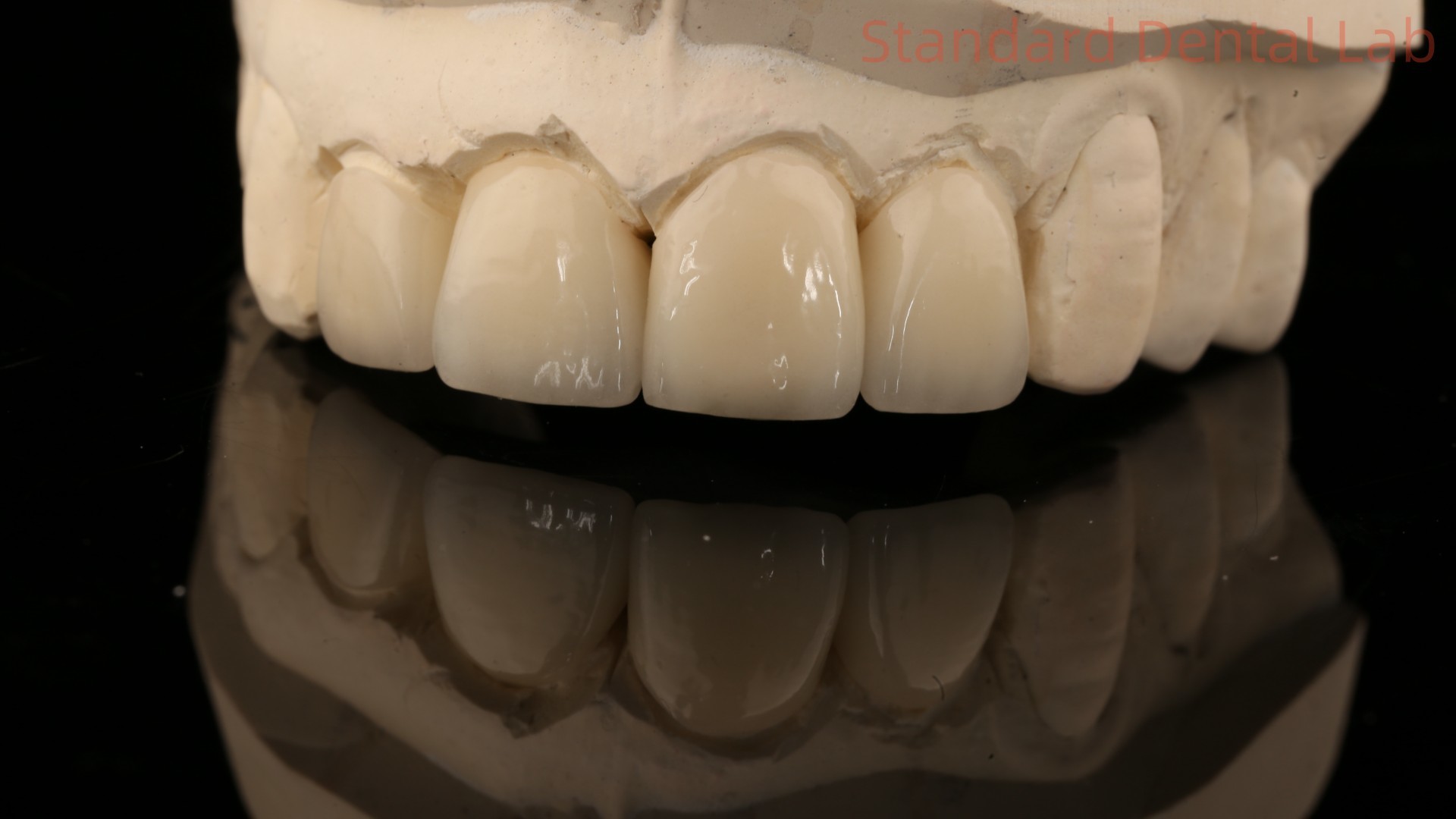 Strong Layered Zirconia Crown And Bridge In Good Esthetics Zirconia Layered China Dental Lab