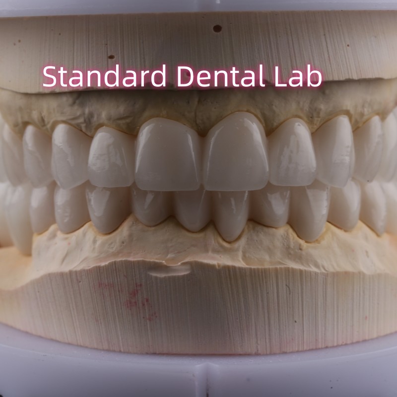 Dental Lab Full Arch Zirconia Porcelain Crowns PFZ Crown ISO FDA CE
