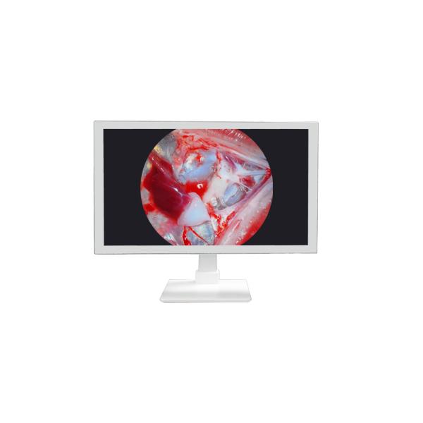 FHD Medical Equipment 22 24 27 Inch Endoscope Camera Monitor Display Full HD