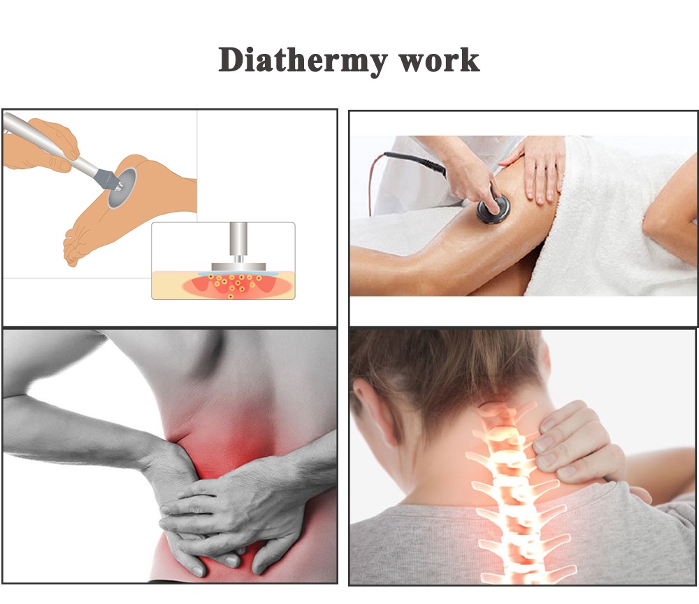 ODM Tecar Therapy Machine Ret And Cet Handles Pain Relieving Machine