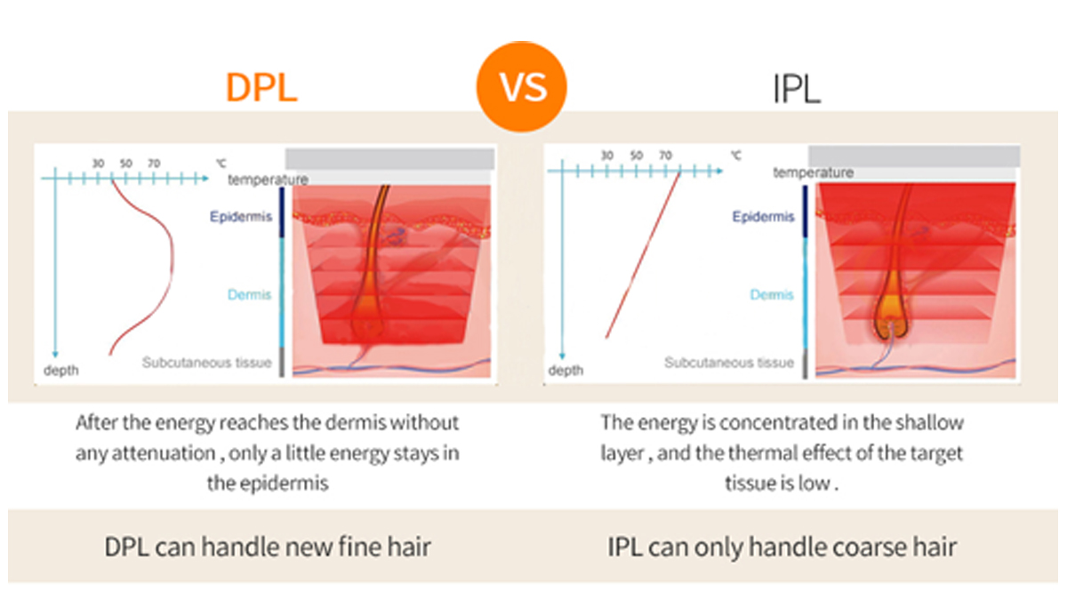 Professional Hair Removal Pigment Removal DPL Skin Rejuvenation Skin Tightening Laser Light Machine
