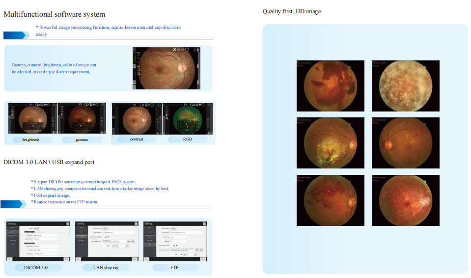 13mm WD Non Mydriatic Fundus Camera 50° FOV Auto/Manual Focus
