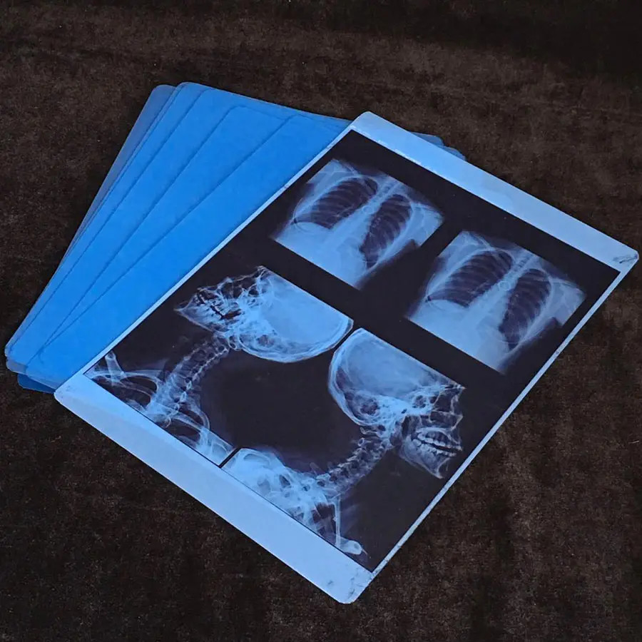 High Resolution PET Base Inkjet X Ray Film for High Printing