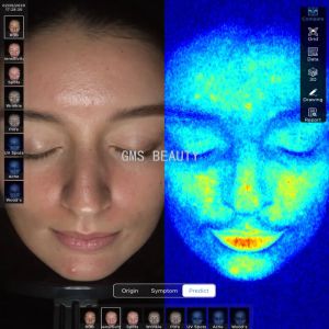Advanced Face Analyzer Machine For Accurate Skin Analysis And Detection Of Skin