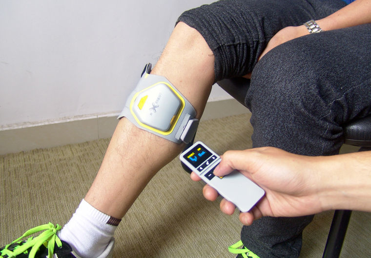 Functional Electrical Stimulation Foot Drop Splint