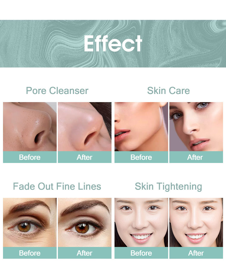 Deep Cleaning Hydra Beauty Machine 10 In 1 Microdermabrasion Skin Care