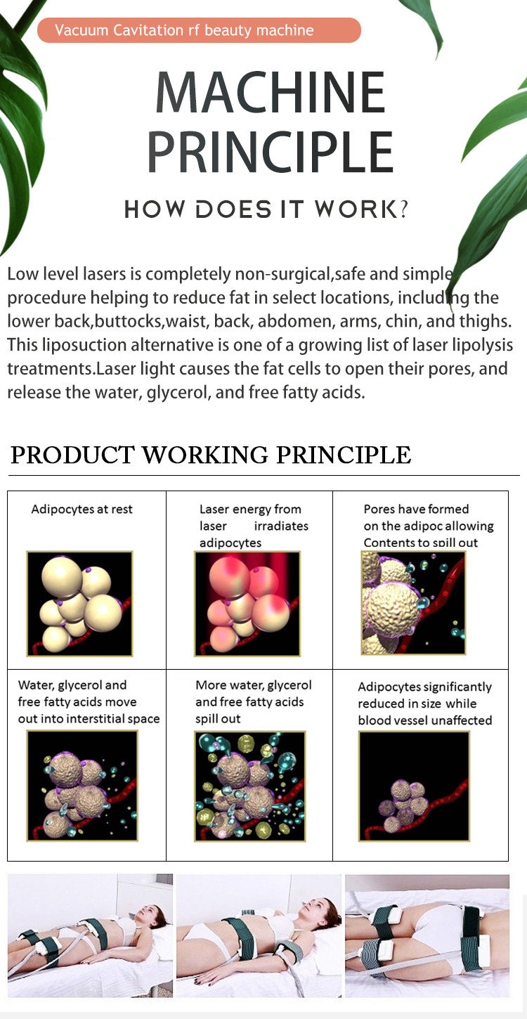 Best Sale Lipo Laser 14 Pads LED lipolaser slimming beauty machine / fat burning laser LF-129c