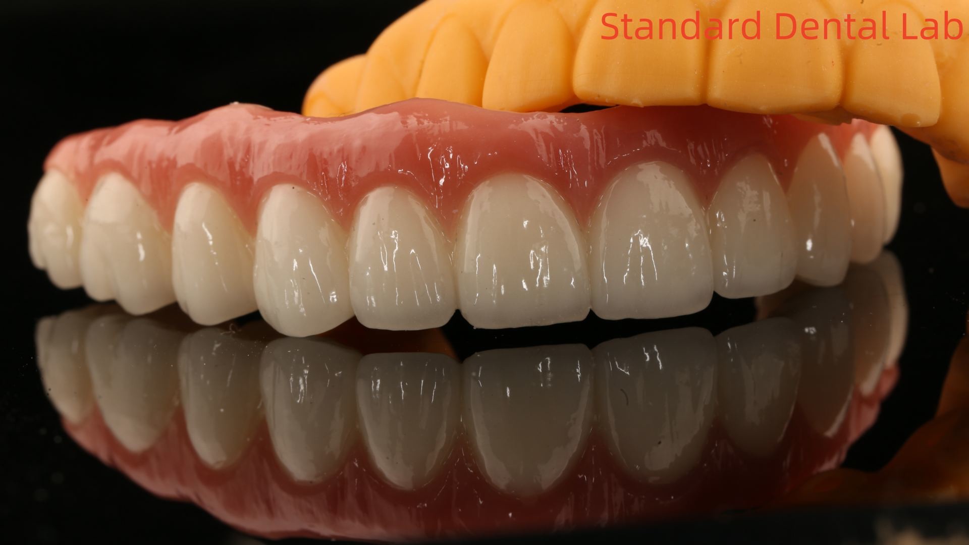 Porcelain All On Four Zirconia Bridge High Esthetics Dental Implant Bridge Screw Retained
