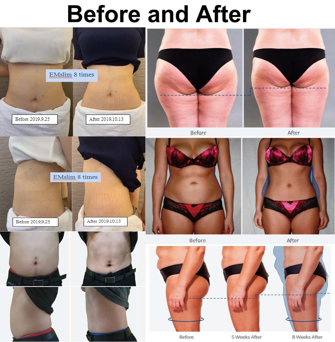 150HZ Frequency EMS Slimming Machine Professional For Enhanced Muscle Toning / Fat Burning
