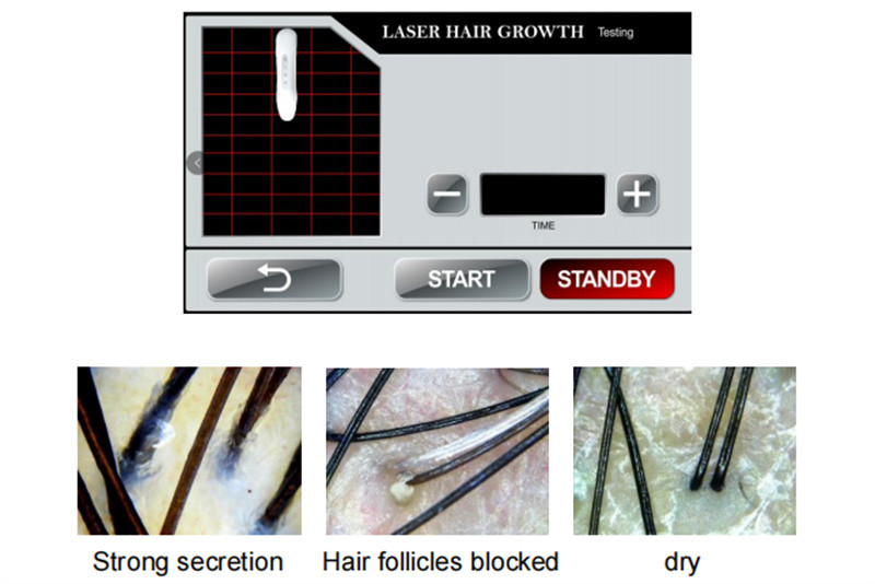 650 Nm Diode Laser Hair Growth Machine Low Level Hair Therapy Analyser