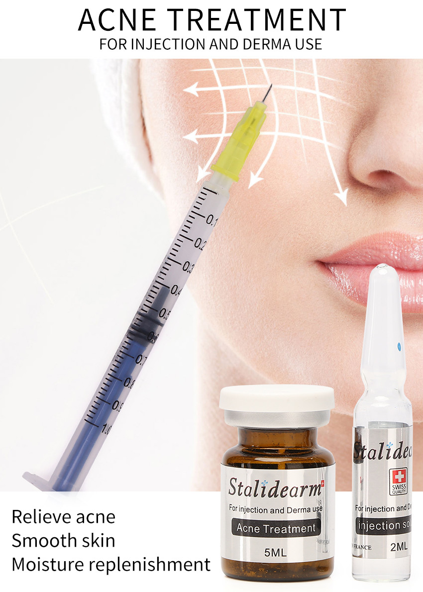 Stalidearm Acne Treatment Injection Serum Mesotherapy Nourishing No Side Effects