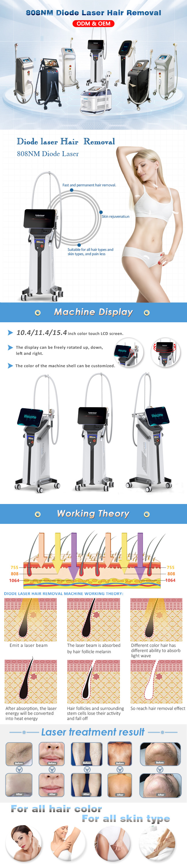 1600watt 808nm Diode Laser Hair Removal Machine Alma Soprano Laser Machine