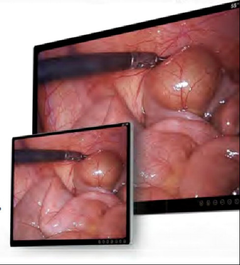 22 Inch Monitor Full HD Endoscope Camera 80W LED Cold Light Source BTH-9122H