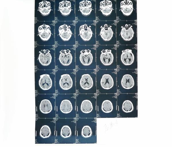 Medical Paper Laser Printer X Ray Diagnostic Imaging For Hospital