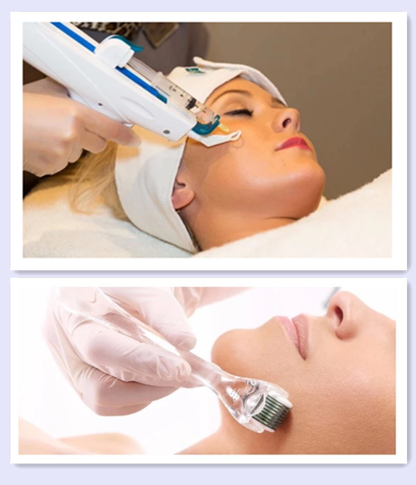 Pcl 1ml Injectable Hyaluronic Acid Dermal Filler Pdrn Skin Booster Meso Solution