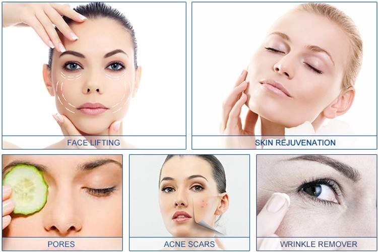 MRF 81 Pin RF Microneedling Machine Skin Rejuvenation SRF Machine