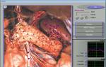 Quantum Resonance 3d Nls Health Analyzer Non Linear Diagnosis System