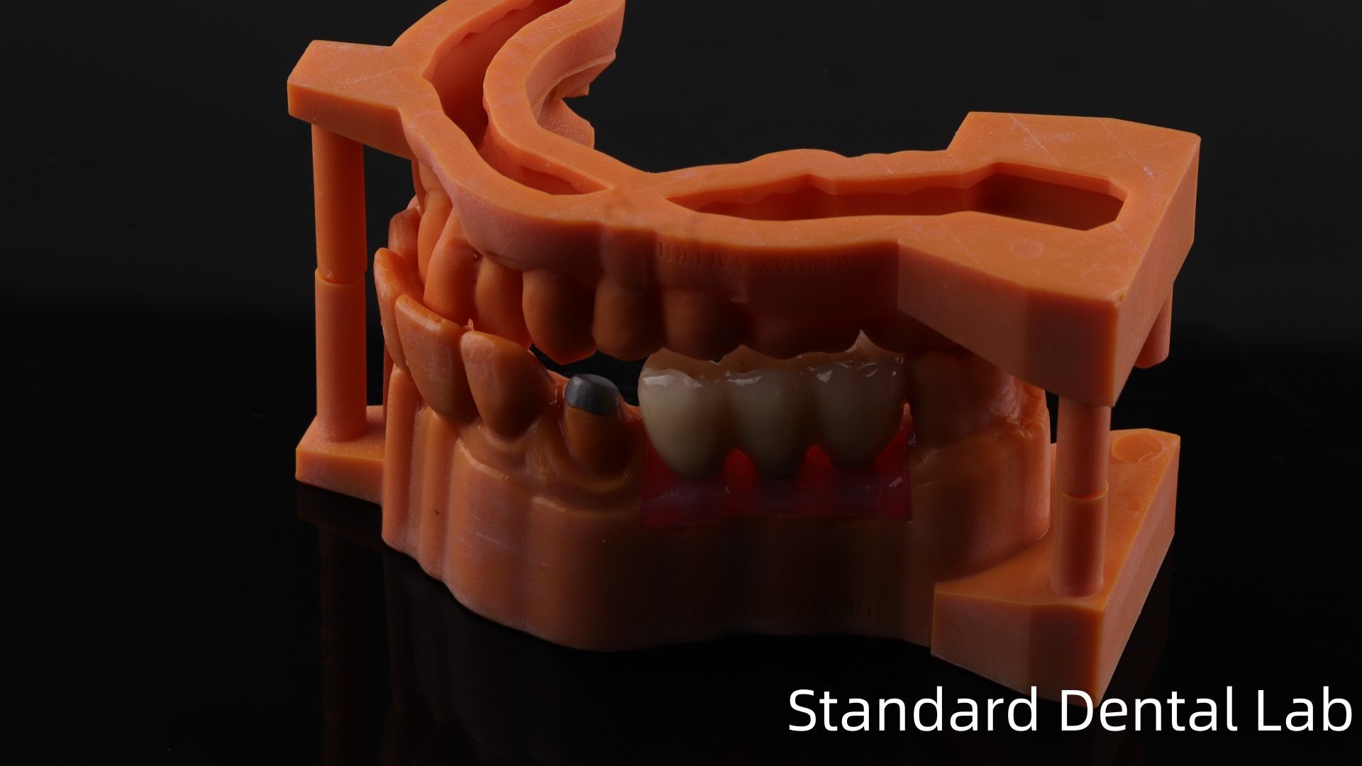Post Core Dental Lab from China / Metal Post Core with PFM Crown