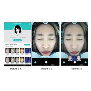 Professional Wrinkle Analysis Software Supporting For Automatic Precise Analysis