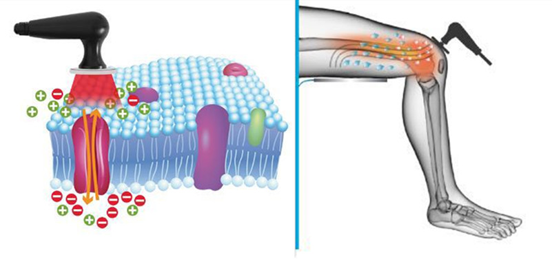 300KHz Radio Frequency Tecar Therapy Machine For Stimulation Venous
