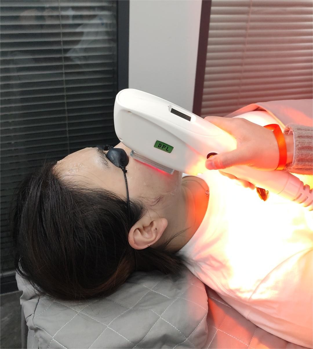 Funtion 4 Regain A Glossy Appearance with IPL Skin Hair Reduction Elight Machine 45kg
