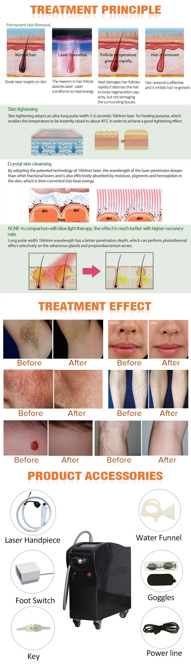 110j/Cm2 Alexandrite Laser Hair Removal 755nm 1064 Yag Long Pulse Laser Depilation