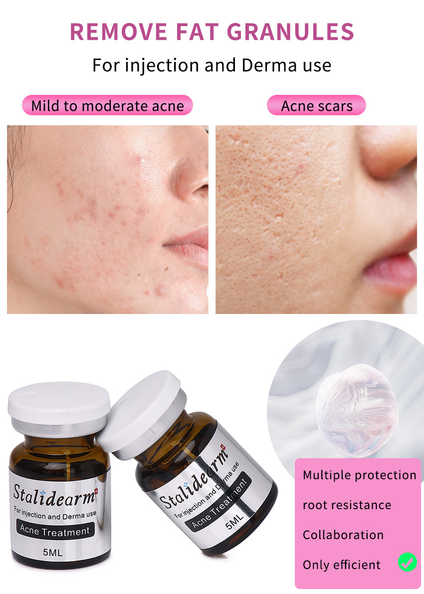 Stalidearm Oil Control And Soothing Skin Booster Serum For Acne Repair And Scar Lightening