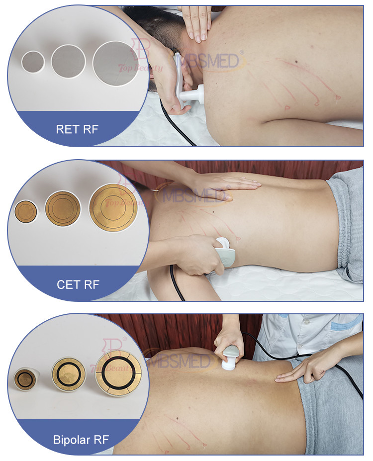 3 In 1 RET CET RF 448khz Tecar Therapy Physiotherapy Tecar Machine