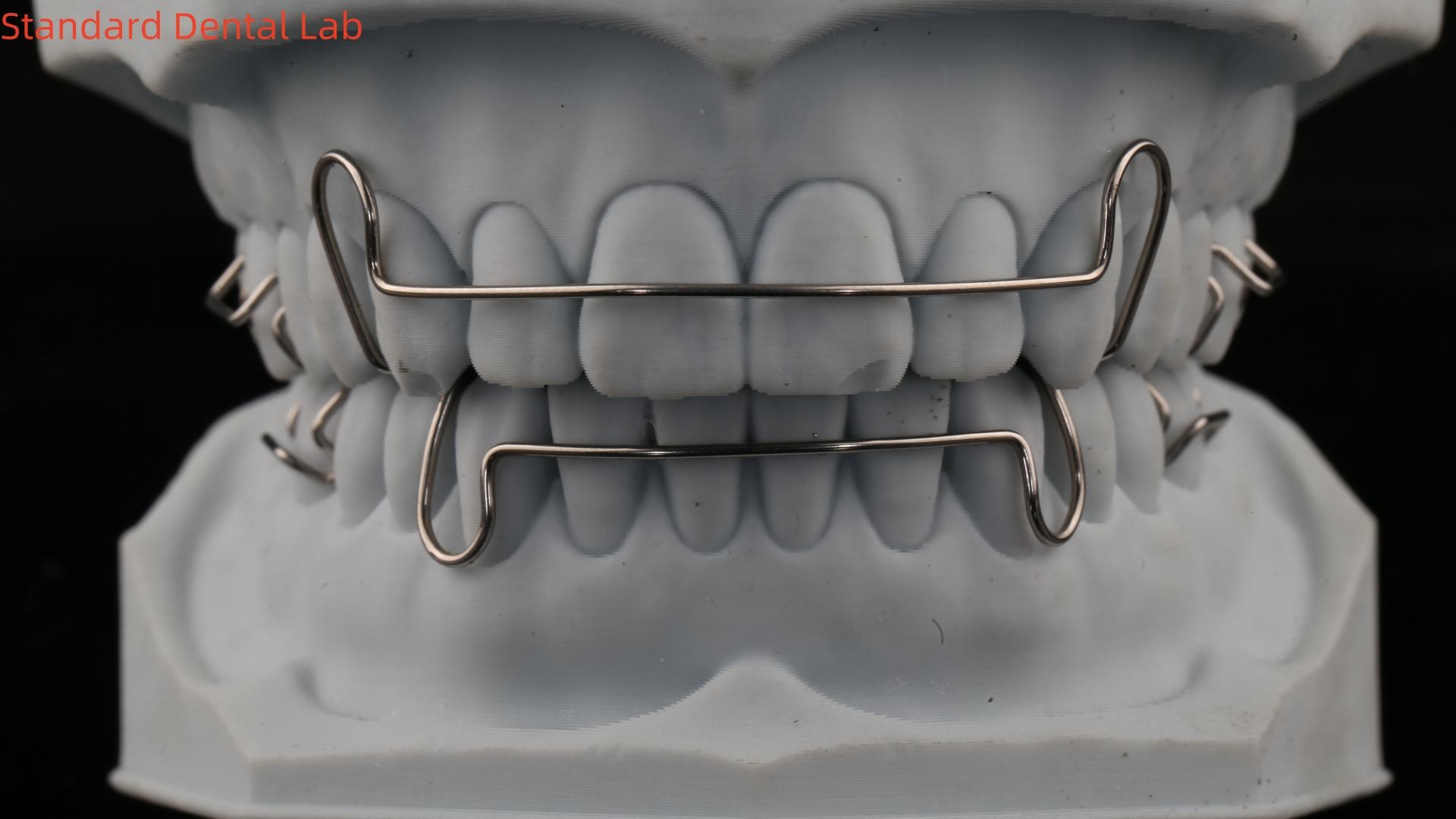 Comfortable Stainless Steel Acrylic Hawley Retainer Effective Orthodontics Appliance