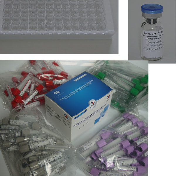 Easy-To-Use FT3 ELISA Test Kit With Long Shelf Life And 2C-8C Preservation Method