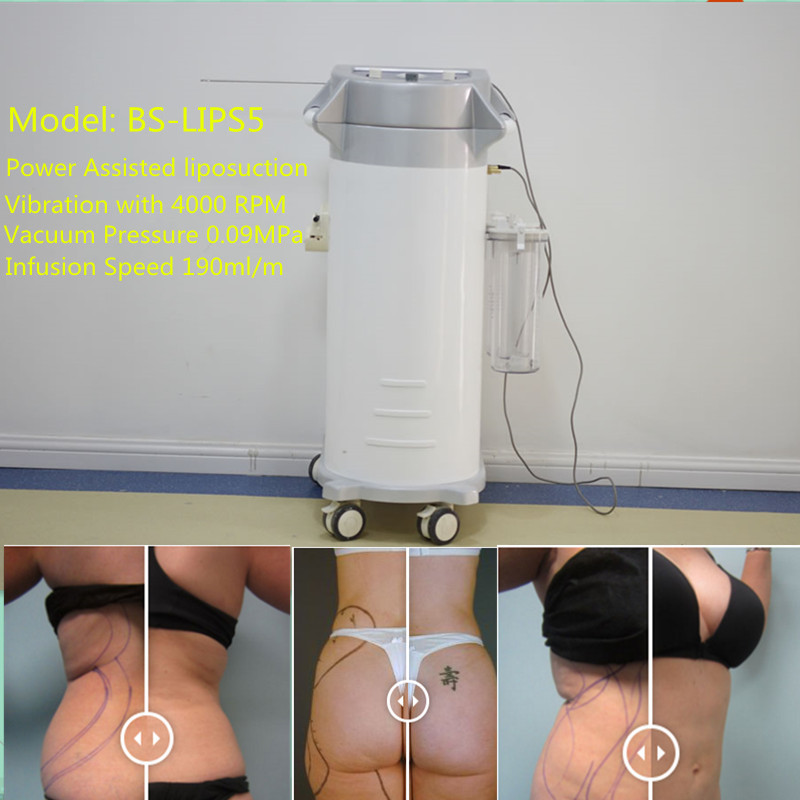 Anaesthetic Infusion System Surgical Liposuction Machine Weight Loss