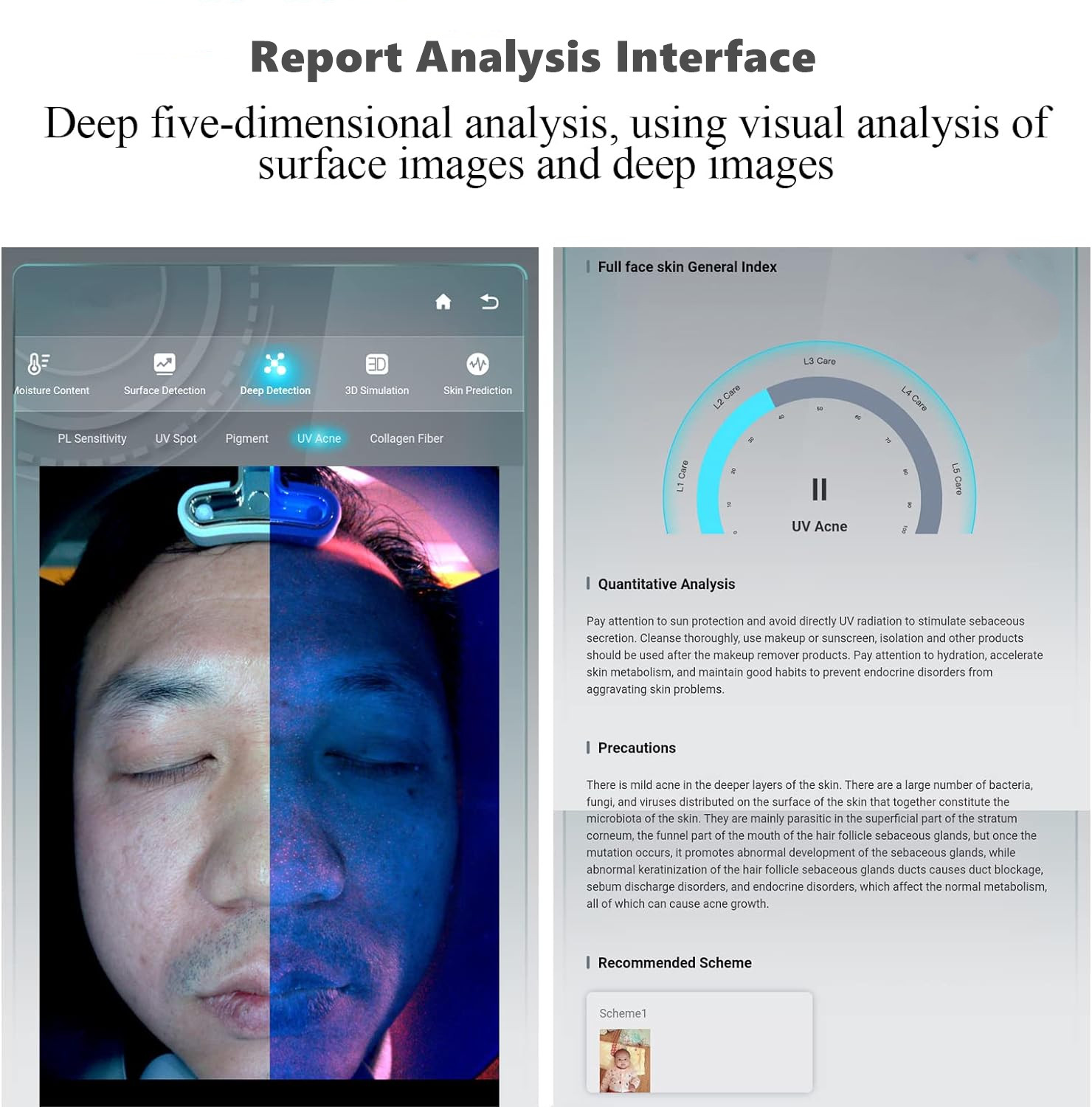 Report analysis interface