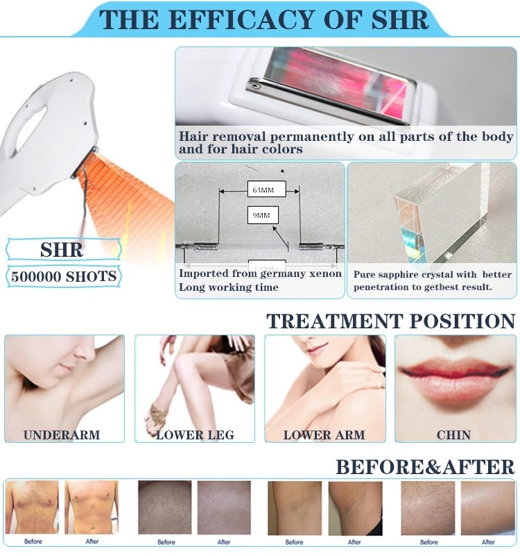 Nubway opt ipl shr korea ipl skin rejuvenation machine for sale intense pulsed light machine