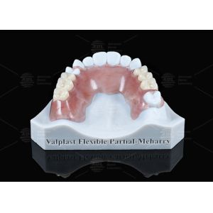 Lightweight Valplast Flexible Partial With Excellent Retention In Pink And
